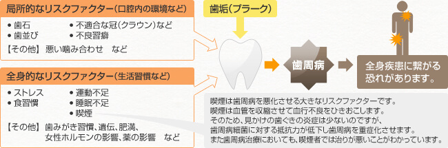 リスクファクター