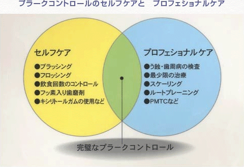 プラークコントロールのセルフケアとプロフェッショナルケア
