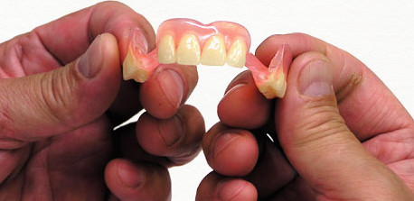 スマイルデンチャー