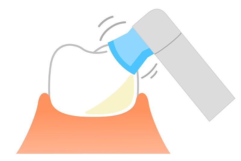 当院で働くメリット