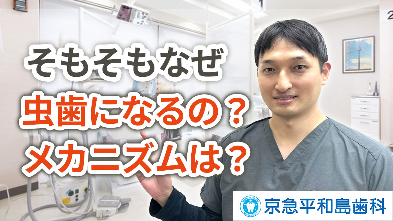 そもそもなぜ虫歯になるのか？メカニズムは？