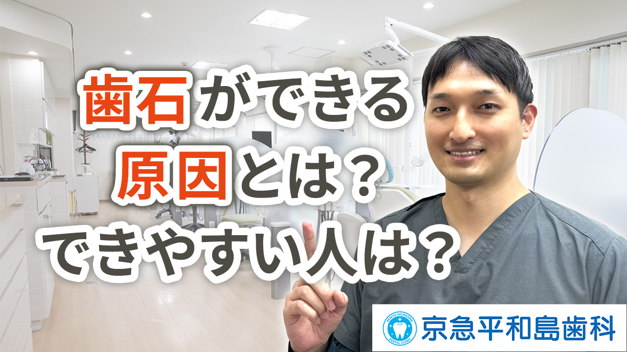 歯石ができる原因とは？できやすい人の特徴は？